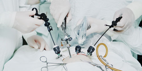 Uterus Removal Operation