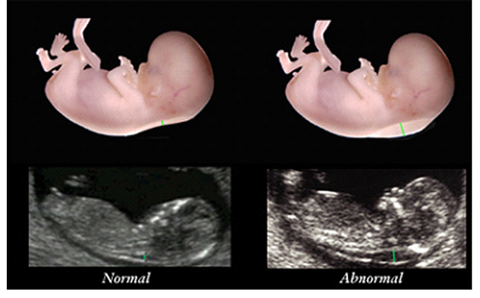 normal abnormal