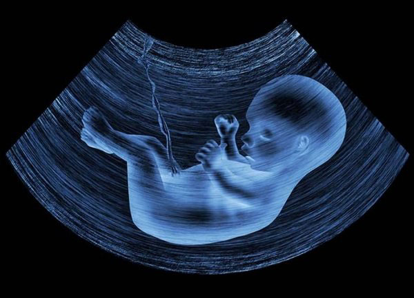 ultrasonla cinsiyet tahmini